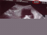 Click image for larger version

Name:	mvc-646f.jpg
Views:	207
Size:	57.0 KB
ID:	15838171