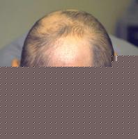 Click image for larger version

Name:	alop.jpg
Views:	431
Size:	5.2 KB
ID:	15867652