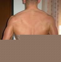 Click image for larger version

Name:	5_7_2008_Dorso.jpg
Views:	100
Size:	31.4 KB
ID:	15881286