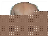 Click image for larger version

Name:	io schiena.jpg
Views:	66
Size:	42.9 KB
ID:	15923707