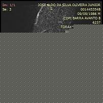 Click image for larger version

Name:	257142_516750_aldo_costela_1.0.jpg
Views:	269
Size:	13.1 KB
ID:	15959922