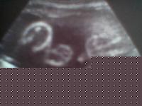 Click image for larger version

Name:	foto(14).jpg
Views:	270
Size:	18.1 KB
ID:	15965891