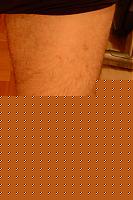 Click image for larger version

Name:	quadricipite.jpg
Views:	89
Size:	111.0 KB
ID:	15972115