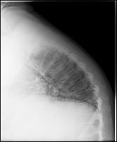 Click image for larger version

Name:	dorsale2013.jpg
Views:	2262
Size:	77.5 KB
ID:	15992175