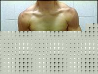 23082011665