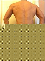 Foto Dorso